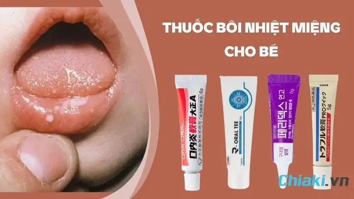 Nhiệt Miệng Tiếng Nhật Là Gì Nhiệt Miệng Tiếng Nhật Là Gì